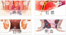 大连金州肛肠医院